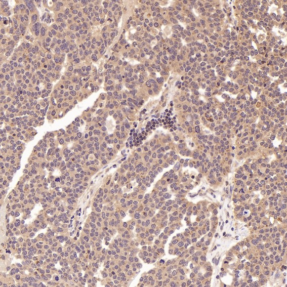 2 - Anti-IRF3 Rabbit Monoclonal Antibody ABO13438