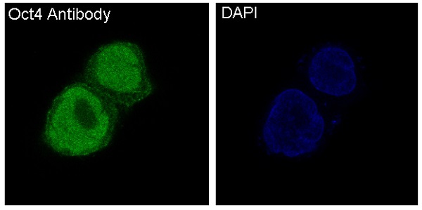 3 - Anti-Oct4 POU5F1 Rabbit Monoclonal Antibody ABO13439