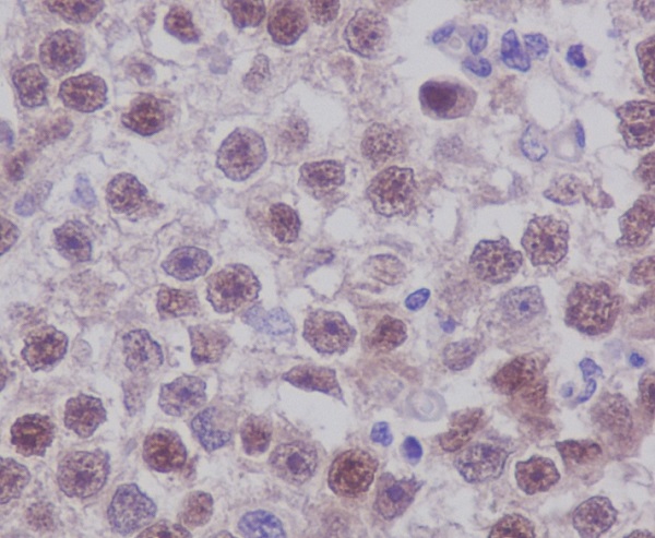 2 - Anti-Oct4 POU5F1 Rabbit Monoclonal Antibody ABO13439