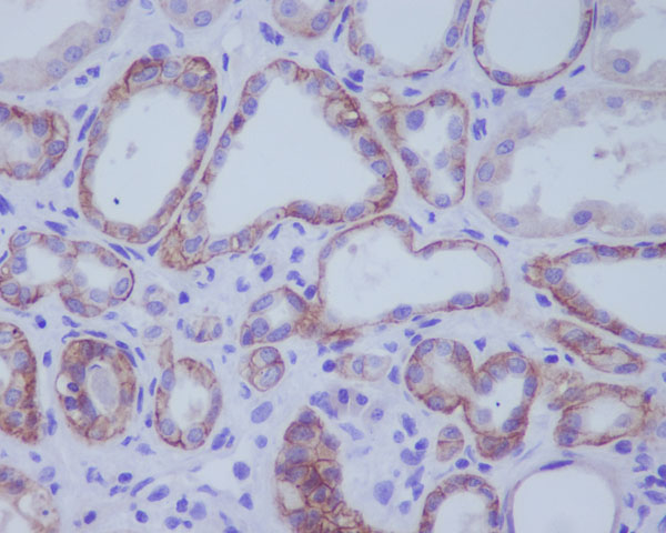 2 - Anti-ACE2 Rabbit Monoclonal Antibody ABO13440
