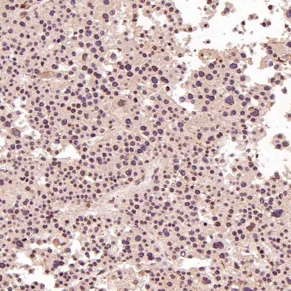 2 - Anti-ACE2 Rabbit Monoclonal Antibody ABO13440