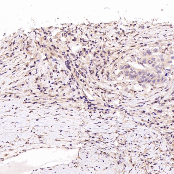 2 - Anti-ACE2 Rabbit Monoclonal Antibody ABO13440