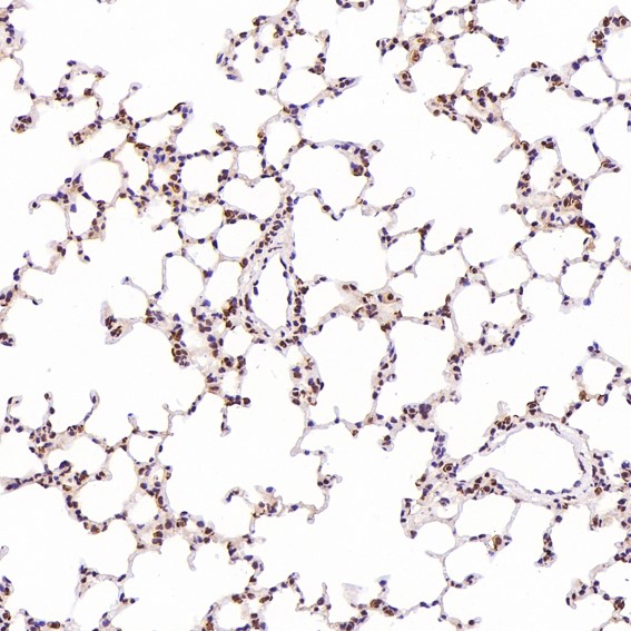 2 - Anti-ACE2 Rabbit Monoclonal Antibody ABO13440