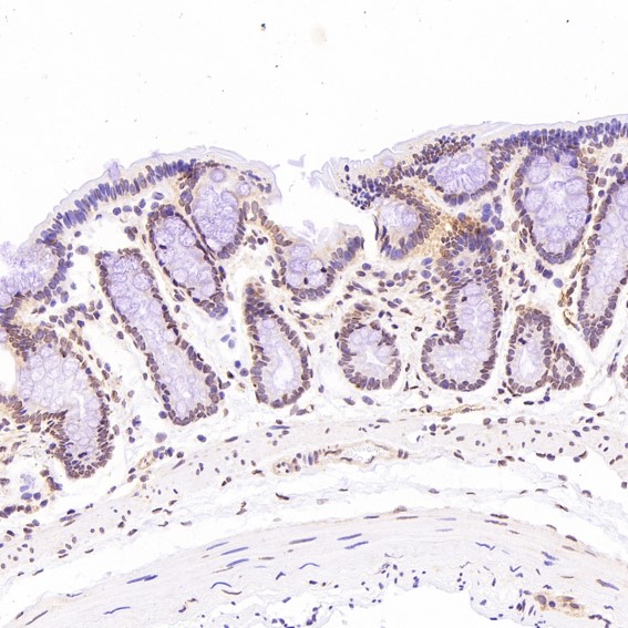 2 - Anti-ACE2 Rabbit Monoclonal Antibody ABO13440
