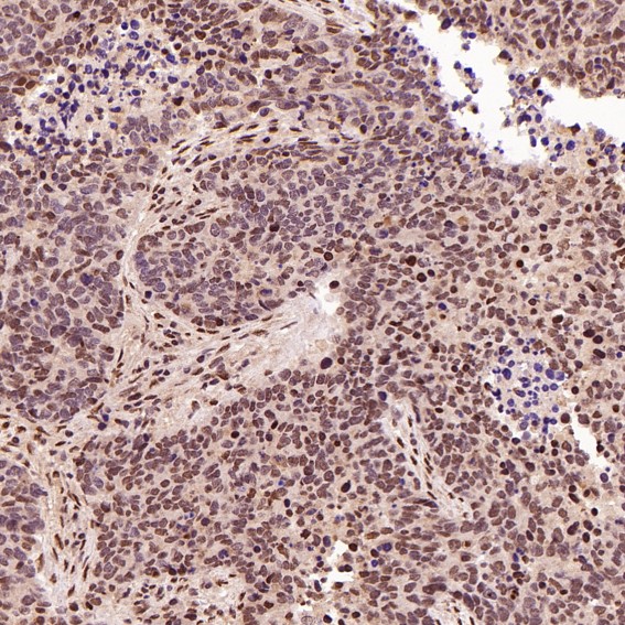2 - Anti-ACE2 Rabbit Monoclonal Antibody ABO13440