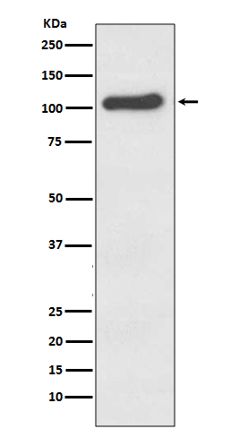 1 - Anti-ACE2 Rabbit Monoclonal Antibody ABO13440