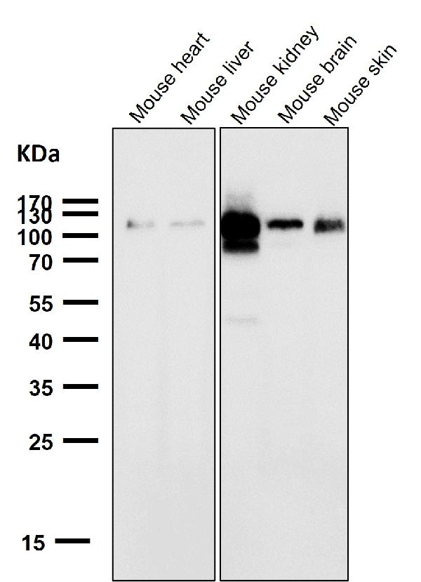 1 - Anti-ACE2 Rabbit Monoclonal Antibody ABO13440
