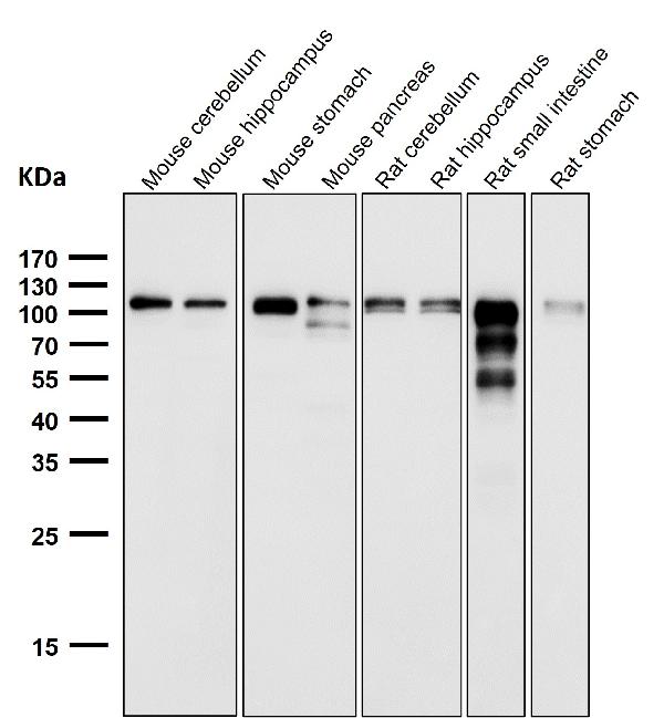 1 - Anti-ACE2 Rabbit Monoclonal Antibody ABO13440