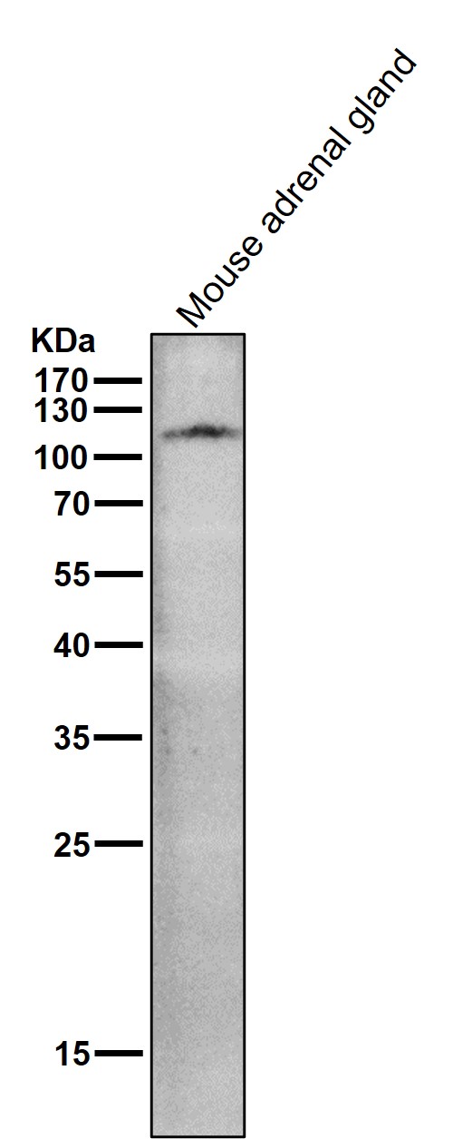 1 - Anti-ACE2 Rabbit Monoclonal Antibody ABO13440