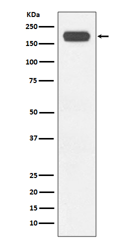 1 - Anti-BRG1 Rabbit Monoclonal Antibody ABO13443