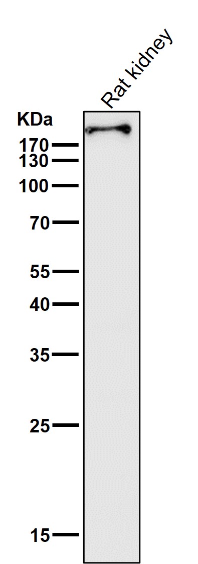 1 - Anti-BRG1 Rabbit Monoclonal Antibody ABO13443