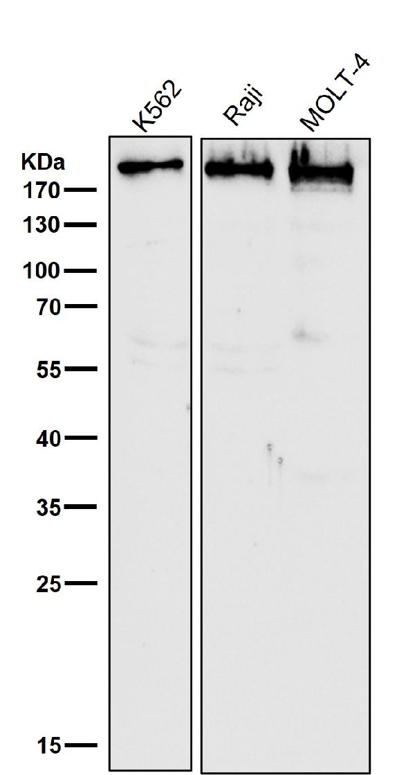 1 - Anti-BRG1 Rabbit Monoclonal Antibody ABO13443