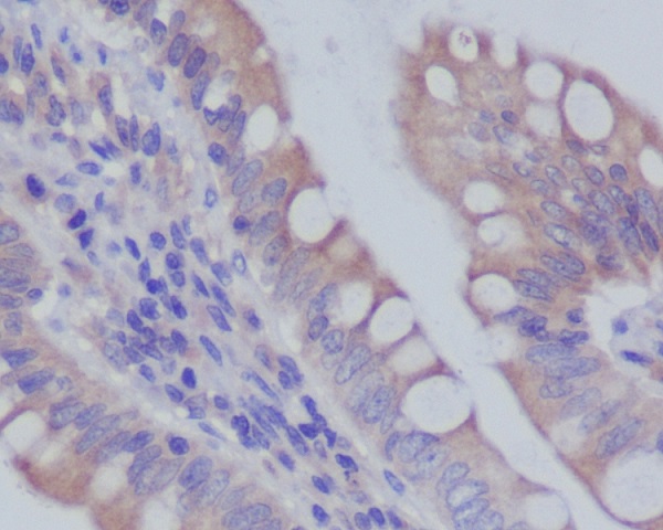 2 - Anti-RAB7 RAB7A Rabbit Monoclonal Antibody ABO13447