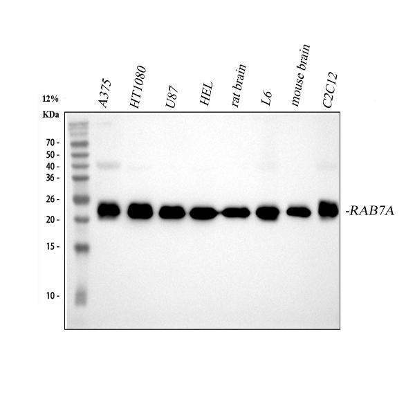 1 - Anti-RAB7 RAB7A Rabbit Monoclonal Antibody ABO13447