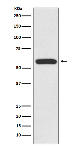 1 - Anti-IRF6 Rabbit Monoclonal Antibody ABO13448