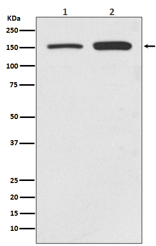 1 - Anti-SMC1 SMC1A Rabbit Monoclonal Antibody ABO13449