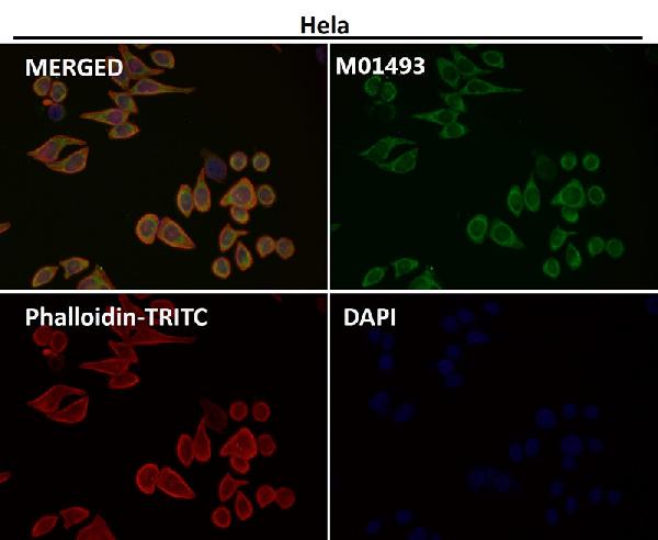 1 - Anti-CDK8 Rabbit Monoclonal Antibody ABO13450