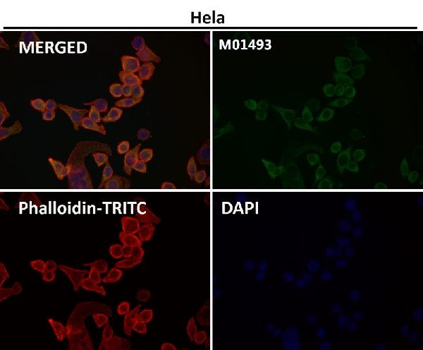 1 - Anti-CDK8 Rabbit Monoclonal Antibody ABO13450