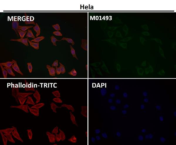 1 - Anti-CDK8 Rabbit Monoclonal Antibody ABO13450