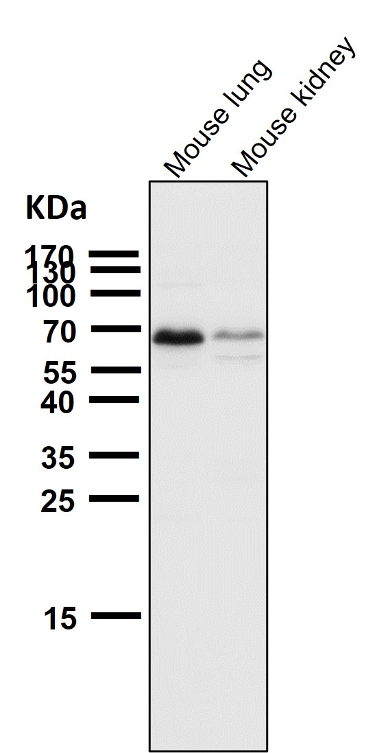 1 - Anti-CDK8 Rabbit Monoclonal Antibody ABO13450