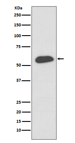 1 - Anti-IRF5 Rabbit Monoclonal Antibody ABO13452