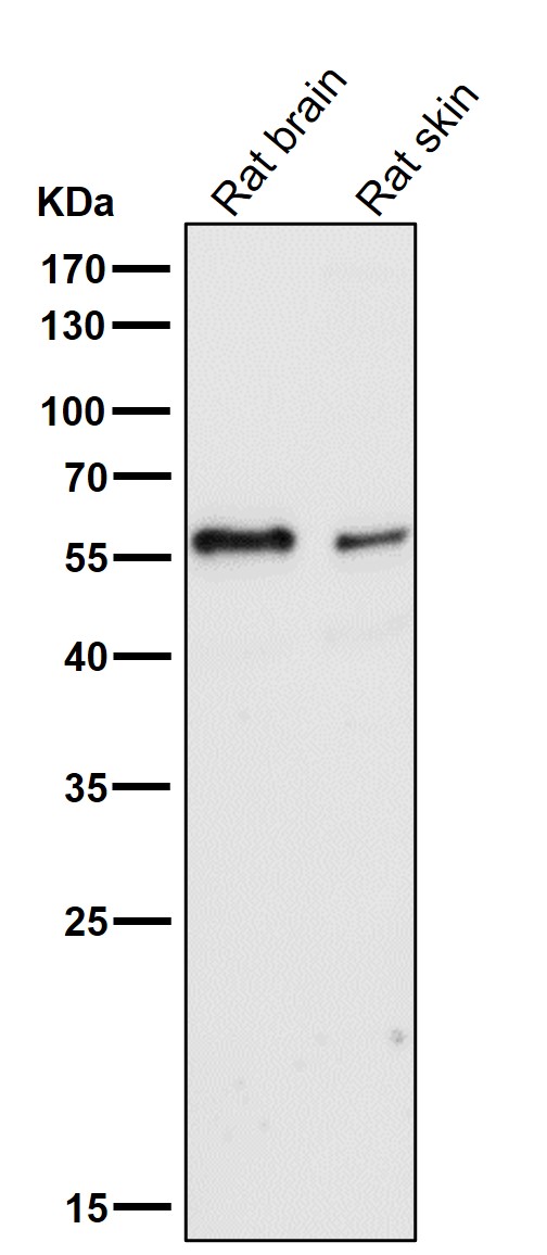 1 - Anti-IRF5 Rabbit Monoclonal Antibody ABO13452