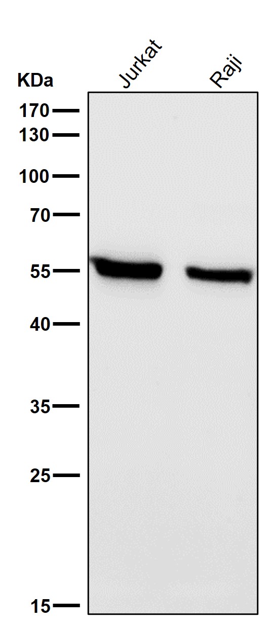 1 - Anti-IRF5 Rabbit Monoclonal Antibody ABO13452