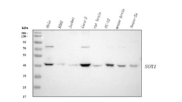 1 - Anti-SOX1 Rabbit Monoclonal Antibody ABO13453