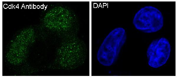 3 - Anti-CDK4 Rabbit Monoclonal Antibody ABO13454