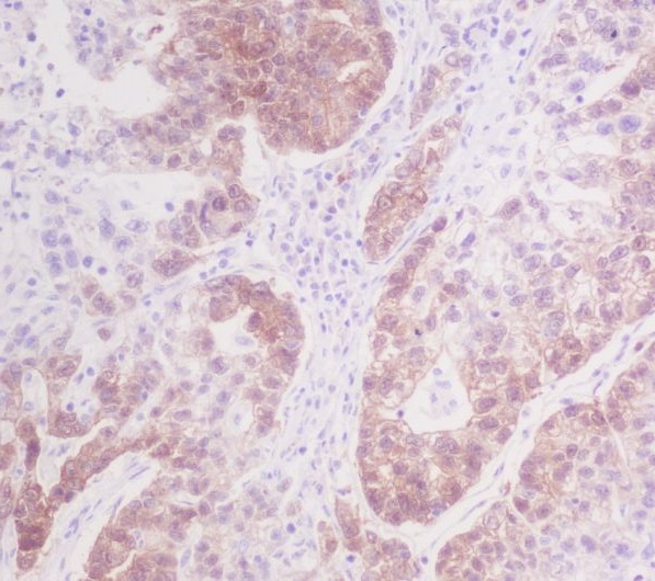 2 - Anti-CDK4 Rabbit Monoclonal Antibody ABO13454