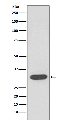 1 - Anti-CDK4 Rabbit Monoclonal Antibody ABO13454