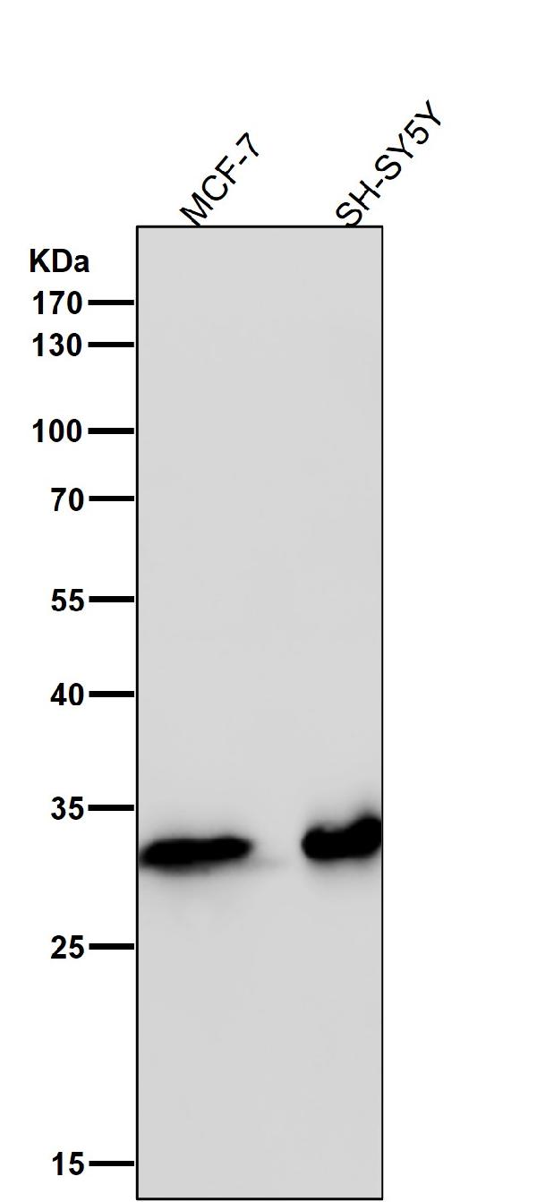 1 - Anti-CDK4 Rabbit Monoclonal Antibody ABO13454