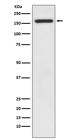 1 - Anti-IRS1 Rabbit Monoclonal Antibody ABO13455