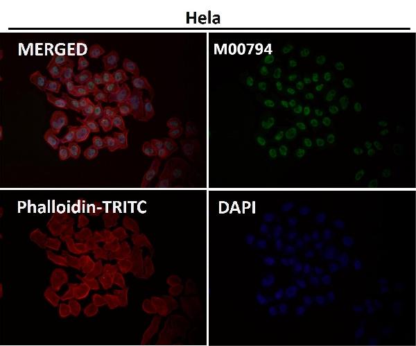 1 - Anti-CDK9 Rabbit Monoclonal Antibody ABO13456