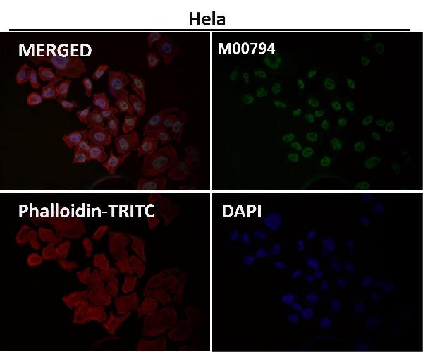 1 - Anti-CDK9 Rabbit Monoclonal Antibody ABO13456