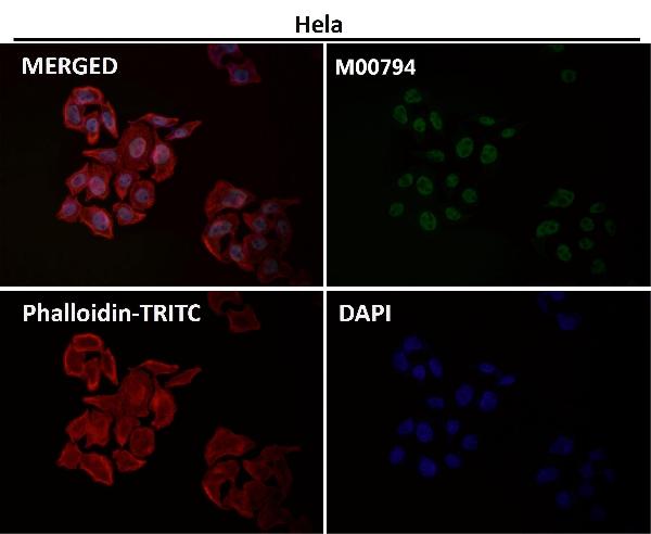 1 - Anti-CDK9 Rabbit Monoclonal Antibody ABO13456