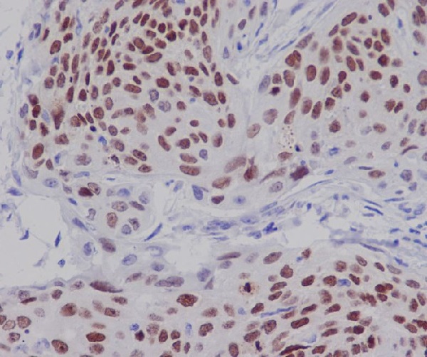 2 - Anti-CDK9 Rabbit Monoclonal Antibody ABO13456