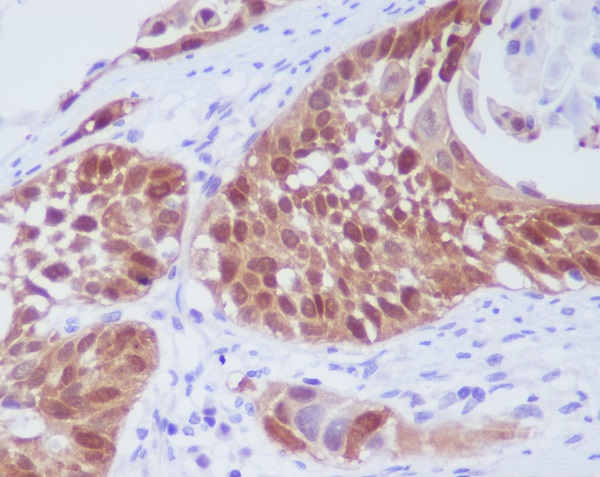 2 - Anti-CDK6 Rabbit Monoclonal Antibody ABO13457