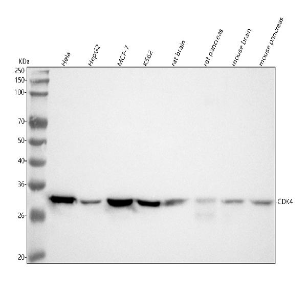 1 - Anti-CDK4 Rabbit Monoclonal Antibody ABO13458