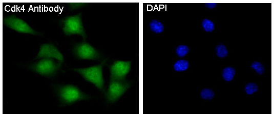 3 - Anti-CDK4 Rabbit Monoclonal Antibody ABO13458
