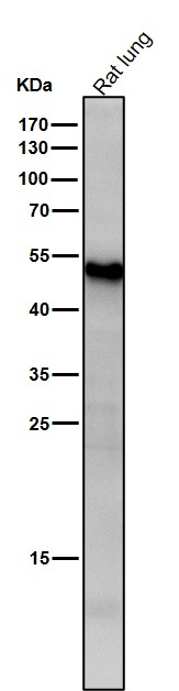 1 - Anti-ATF7 Rabbit Monoclonal Antibody ABO13460