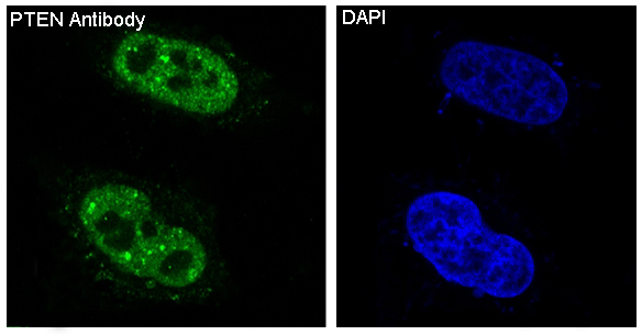 3 - Anti-PTEN Rabbit Monoclonal Antibody ABO13462