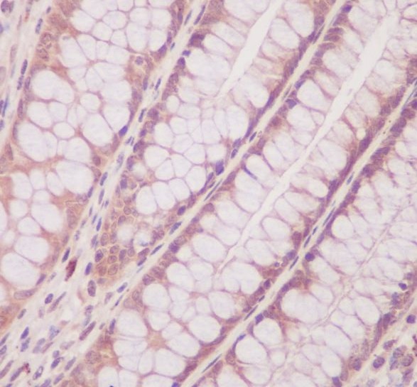2 - Anti-PTEN Rabbit Monoclonal Antibody ABO13462