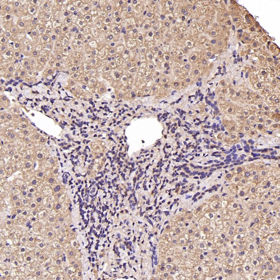 2 - Anti-PTEN Rabbit Monoclonal Antibody ABO13462