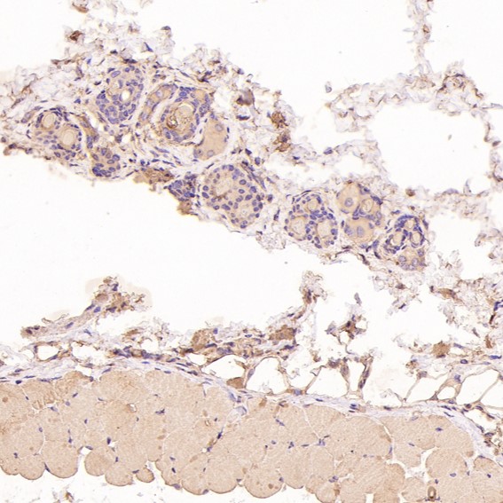 2 - Anti-PTEN Rabbit Monoclonal Antibody ABO13462
