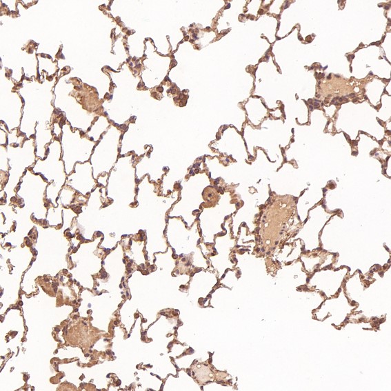 2 - Anti-PTEN Rabbit Monoclonal Antibody ABO13462