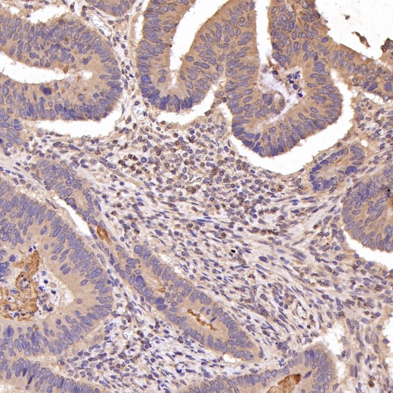 2 - Anti-PTEN Rabbit Monoclonal Antibody ABO13462