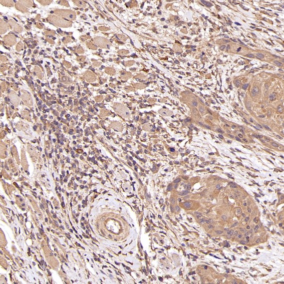 2 - Anti-PTEN Rabbit Monoclonal Antibody ABO13462