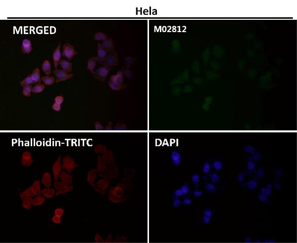 1 - Anti-ERK5 Rabbit Monoclonal Antibody ABO13464