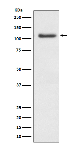 1 - Anti-ERK5 Rabbit Monoclonal Antibody ABO13464